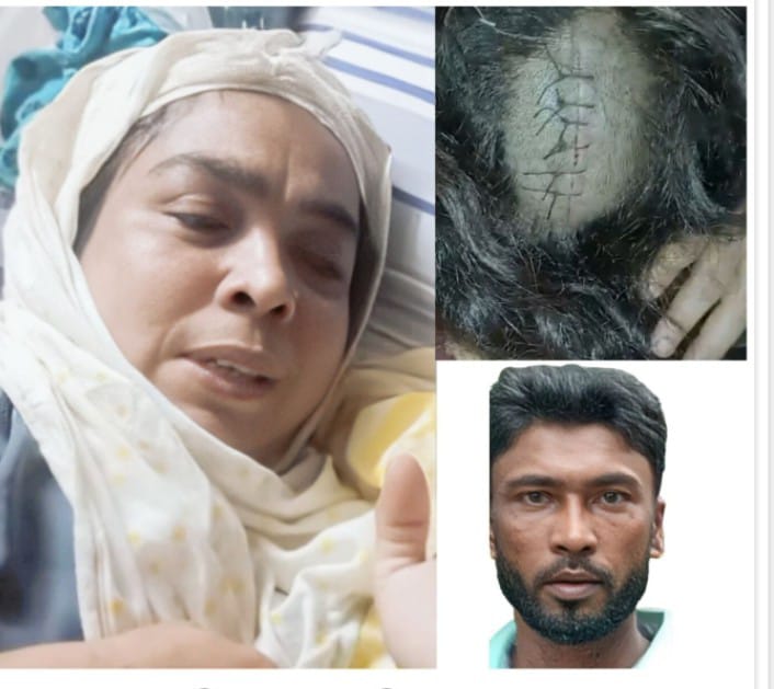 বানারীপাড়ায় সম্পত্তির লোভে সৎমার ওপর সন্ত্রাসী হামলা, গ্রেফতার ১